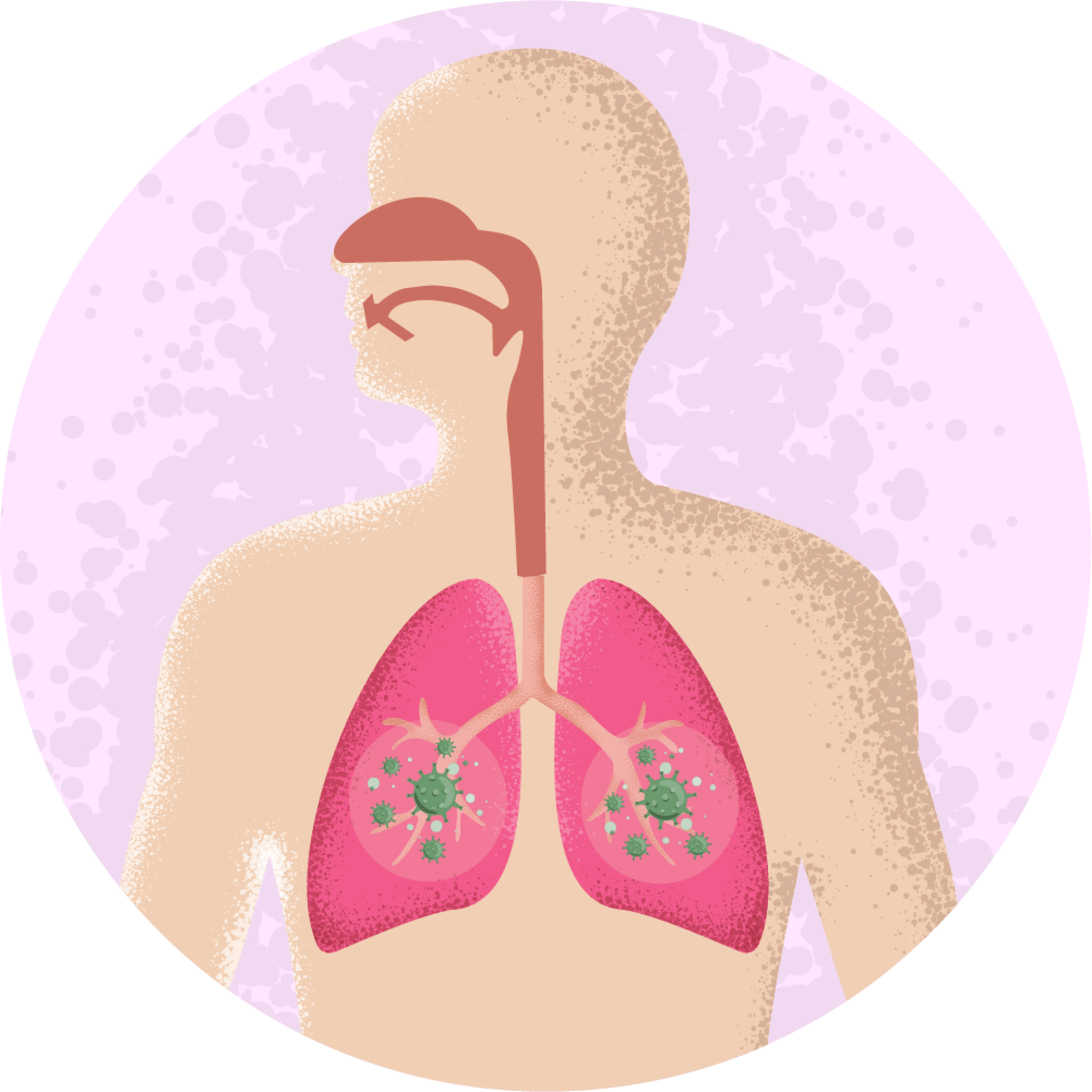 Upper Respiratory Tract Infection (Urti)