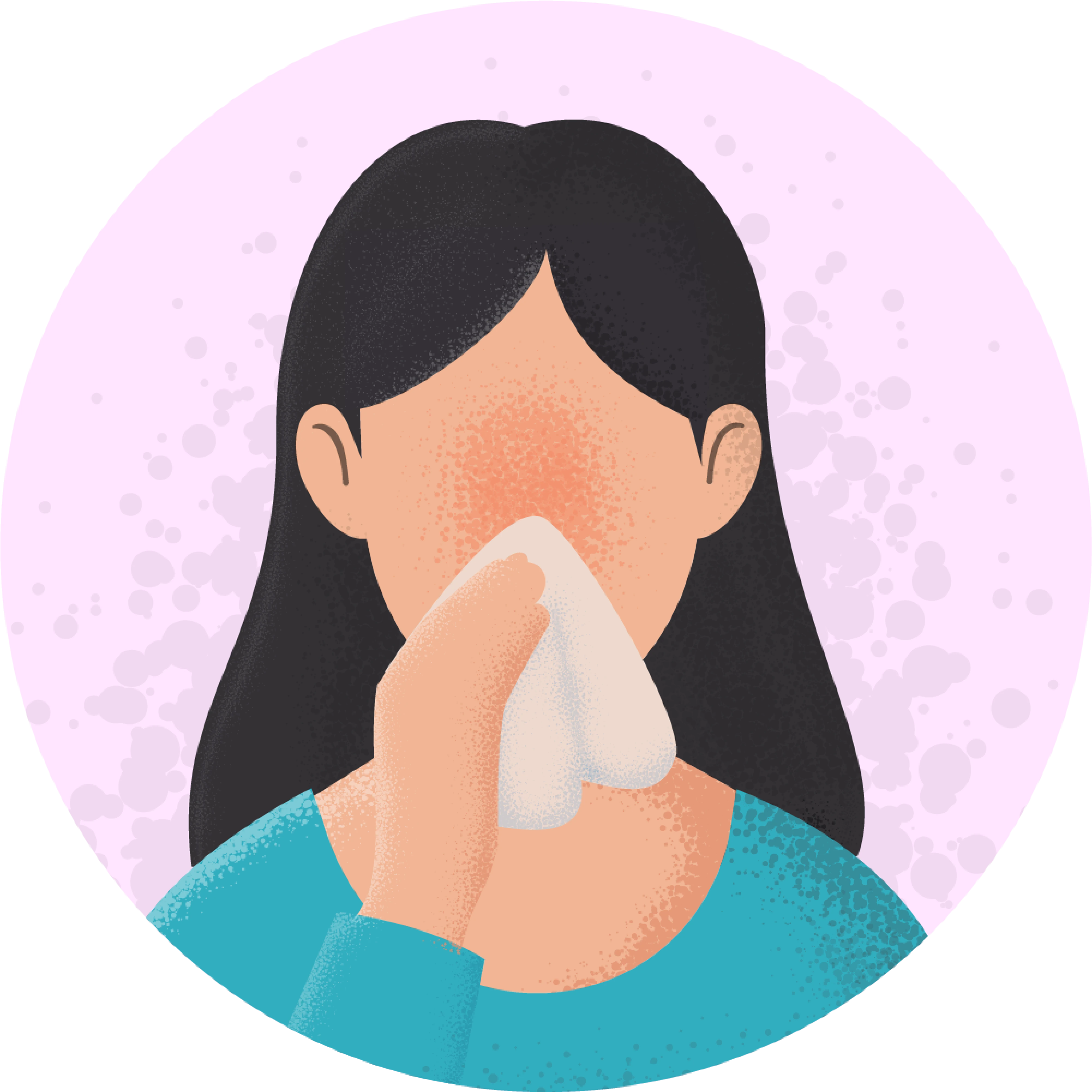 Rhinitis